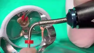 CONTINUOUS WAVE TECHNIQUE FI-P AND FI-E (WOODPECKER)