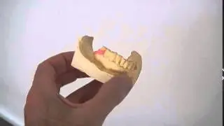 Dentalika - modellazione di 2 ganci