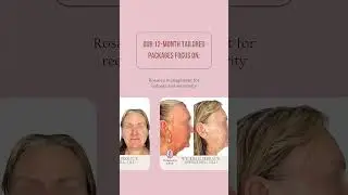 Brisbane&rsquo;s Most Trusted Skincare Experts | Achieve Healthy, Glowing Skin | Primavera Clinic