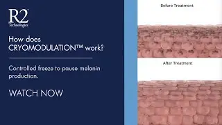 How Does Cryomodulation&trade; Work?