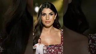 Yeliz Koc: Fr&uuml;her vs. Heute #yelizkoc #dschungelcamp #beautydoc #fr&uuml;hervsheute #hyaluron