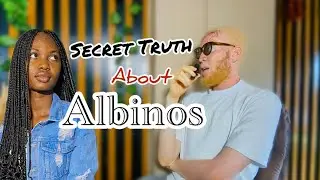 Living With Albinism: The Life,Myths and The Truth