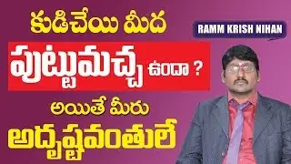 Moles Astrology in Telugu || mole on right hand || Puttu Macha Jathakam || Puttumachha sasram.