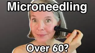 MICRONEEDLING to Boost Collagen & Get the Glow Over 60 | Full Face Demonstration
