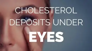 Cholesterol deposits under eyes and how to remove them.