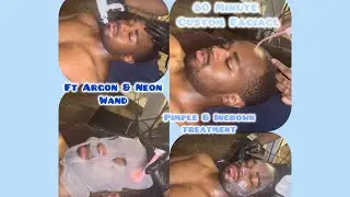 60 Minute Custom Facial for Ingrown hair & pimples|Ft Argon wand and Neon wand