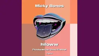 Micky Bones