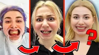 YENİ DİŞLERİME BAKKIIIIN ! 🥳 | Baştan Sona Diş Tedavi Sürecim 🦷