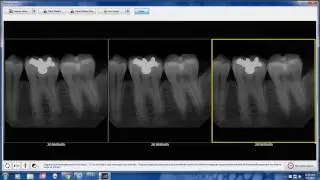 Features and Highlights of Advanced Imaging V4 | DentiMax Webinar