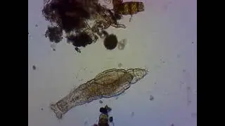 Коловратка Philadina (Тип Rotifera)