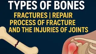 Bone Fracture| Fracture Repair process| and Injuries of Joints| 10th and 12th Biology 