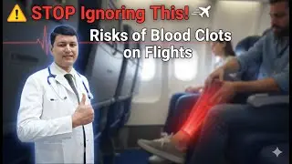 STOP Ignoring the Risks of Blood Clots on Flights