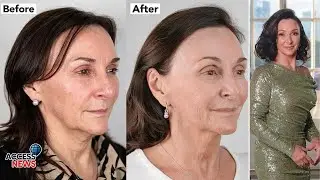 💃✨ Shirley Ballas Shocks Fans with Her New Radiant Look at 65! 🌟💎