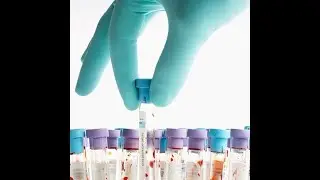Therapeutic Drug Monitoring Market 2025, Precision Medicine's Next Big Frontier!