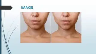Best Mole Removal in Belleknowes
