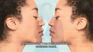 Rinoplastia | Entenda sua evolução ao longo dos anos