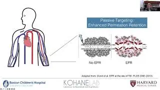 Developing Drug Delivery System for Venous Malformation