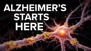 What causes Alzheimer's Disease? (Scientific Proof)