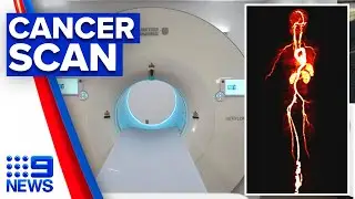 New technology to detect cancer in one scan | 9 News Australia