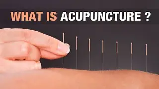 What is Acupuncture ?? || Treatment by Acupuncture || Dadu Acupuncture Clinic, Delhi || Ganga Dadu