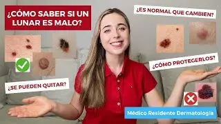 C&Oacute;MO SABER SI UN LUNAR ES MALO | &iquest;ES NORMAL QUE CAMBIEN? &iquest;SE PUEDEN QUITAR? C&Oacute;MO PROTEGERLOS DEL SOL