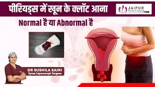 पीरियड्स में #bloodclotting सामान्य हैं क्या? | Is it Normal to Have Blood Clots During Periods?
