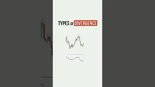 Types of Divergence #shorts #stockmarket #daytrading