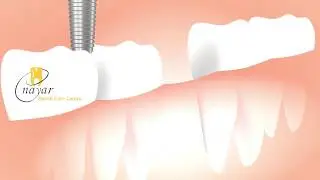 Best Dental Clinic in Noida  | Nayar Dental Care Center