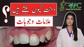 Tooth Mobility By Dr Saira | Dentist | Rehman Medical Center | Islamabad | Blue Area