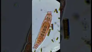 Why you need sanitizer camping #rock #microorganisms #science #microscope
