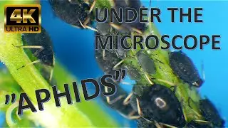 APHIDS - Under the microscope (