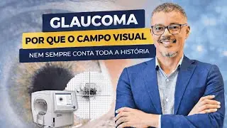 Glaucoma: por que o campo visual nem sempre conta toda a história?