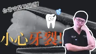 每天都在咬緊牙關？當心牙齒悄悄出現裂痕