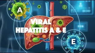 Viral Hepatitis A & E