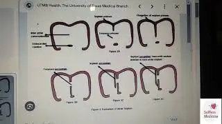 FCPS 1 CVS EMBRYOLOGY lecture 1 cardiac looping, atrial septation