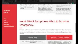 Machine Learning based Heart Disease detection model
