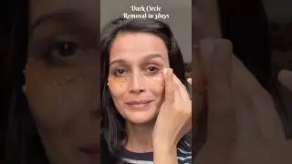 Dark under eyes ✨👁️&zwj;🗨️👁️ #skincare #homeremady #shorts