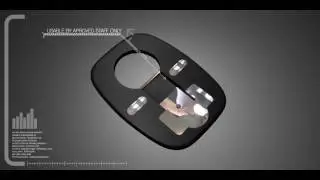 Concept Deactivator