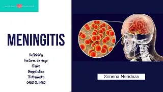 MENINGITIS: clínica, diagnóstico, tratamiento, caso clínico ¿Qué nos dice la GPC ? #ENARM