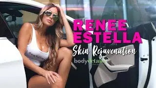 Laser Scar Removal Treatment | Renee Estella | Body Details