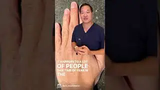Dry Itchy Hands in the Fall and Winter - Dermatologist Tips