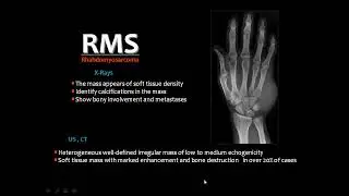 Soft tissue tumors imaging III DRE Prof  Mamdouh Mahfouz HD