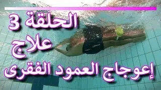 الحلقة رقم 3 من سلسلة علاج جنف أو أعوجاج العمود الفقري Scoliosis  فى الماء بتمارين مبتكرة وحصرية