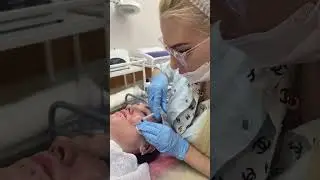 #beauty #skin #skincare #facial #makeup #injection #cosmetology #botox #lipoliz
