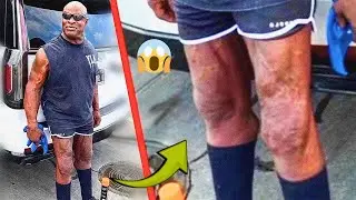 What Happened to RONNIE COLEMAN&rsquo;s Legs?