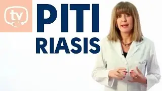 Cómo saber si unas manchas en la piel pueden ser pitiriasis versicolor