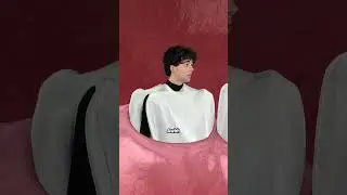 Зуб мудрости #шорты