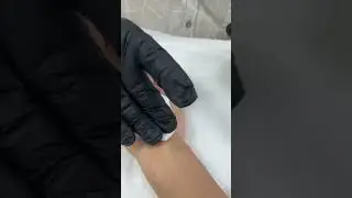 Биоревитализация. Обучение❤️&zwj;🔥 Игла 30G/31G * 4mm/6mm/8mm/12mm/13mm , глубина-срез иглы, угол 15-30
