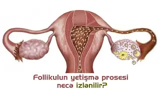 Follikulun yetişmə prosesi necə izlənilir? - cərrah mama-ginekoloq uzman dr. Aynurə Nəcəfəliyeva