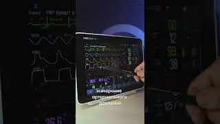 Обзор монитора пациента от компании Medical Econet Proview 12. Часть 15 Настройка #shorts #медицина